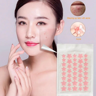 35/40Pcs Colorful Acne Patches Cute Star Heart Shaped Acne Treatment Sticker Invisible Acne Cover Removal Pimple Patch Skin Care